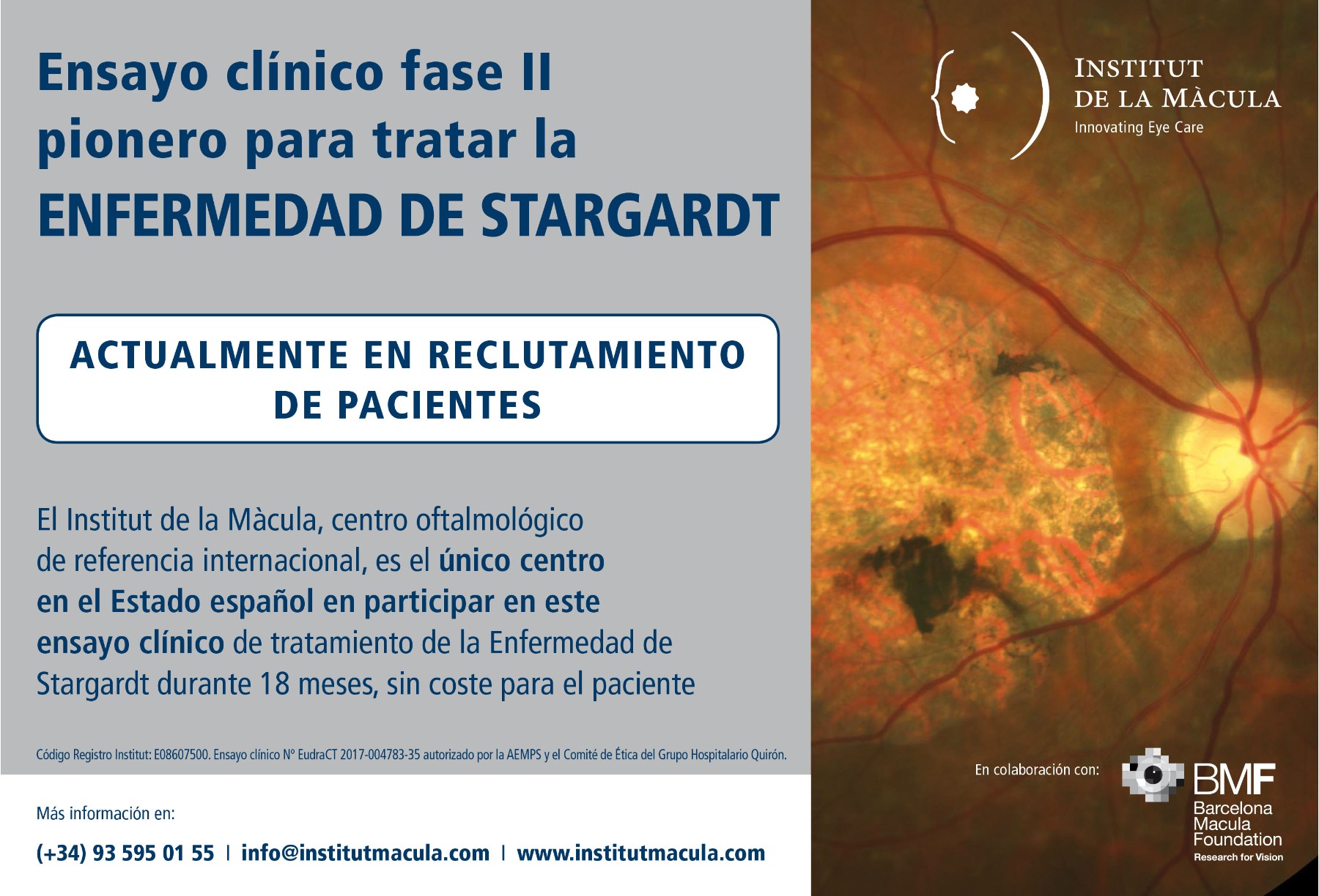 Ensayo clínico fase II pionero para tratar la ENFERMEDAD DE STARGARDT — free download